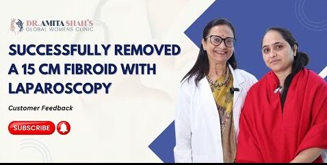 Laparoscopic Surgery for Fibroids