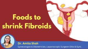 Best Foods To Shrink Fibroids Naturally Dr.Amita Shah