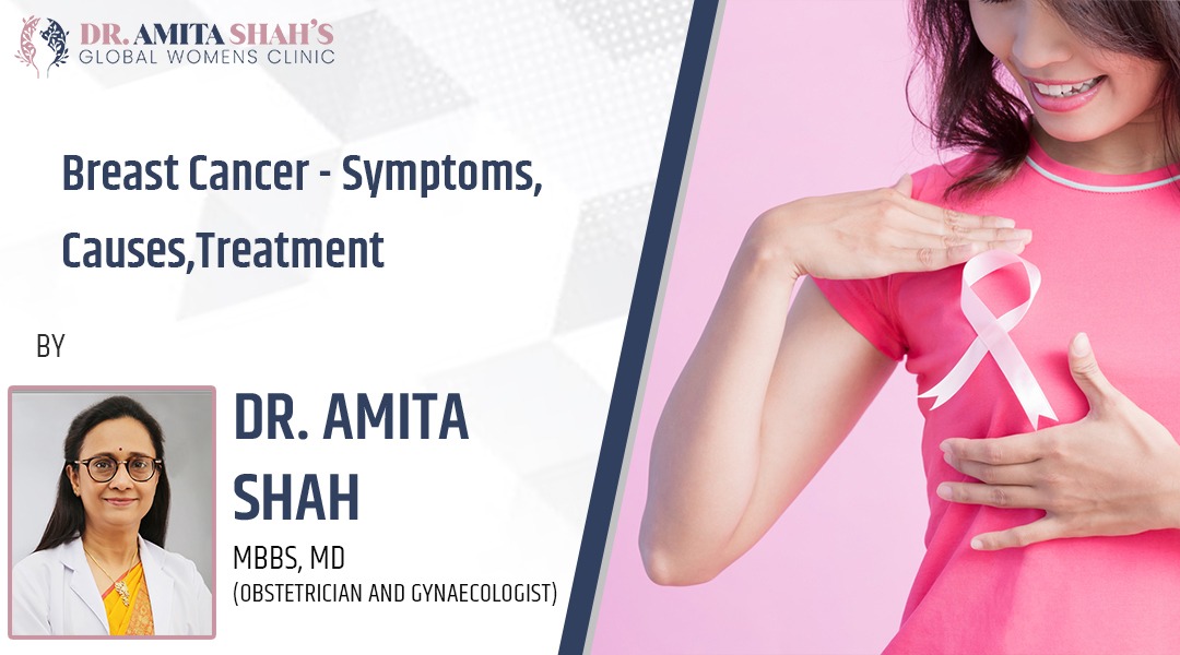 Breast cancer symptoms, causes, treatment