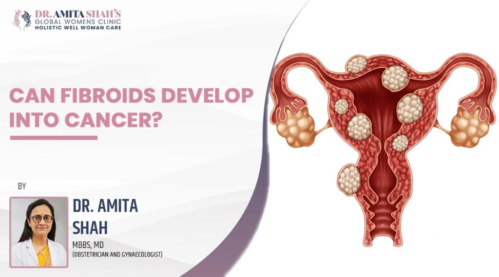 Can Fibroids Develop Into Cancer