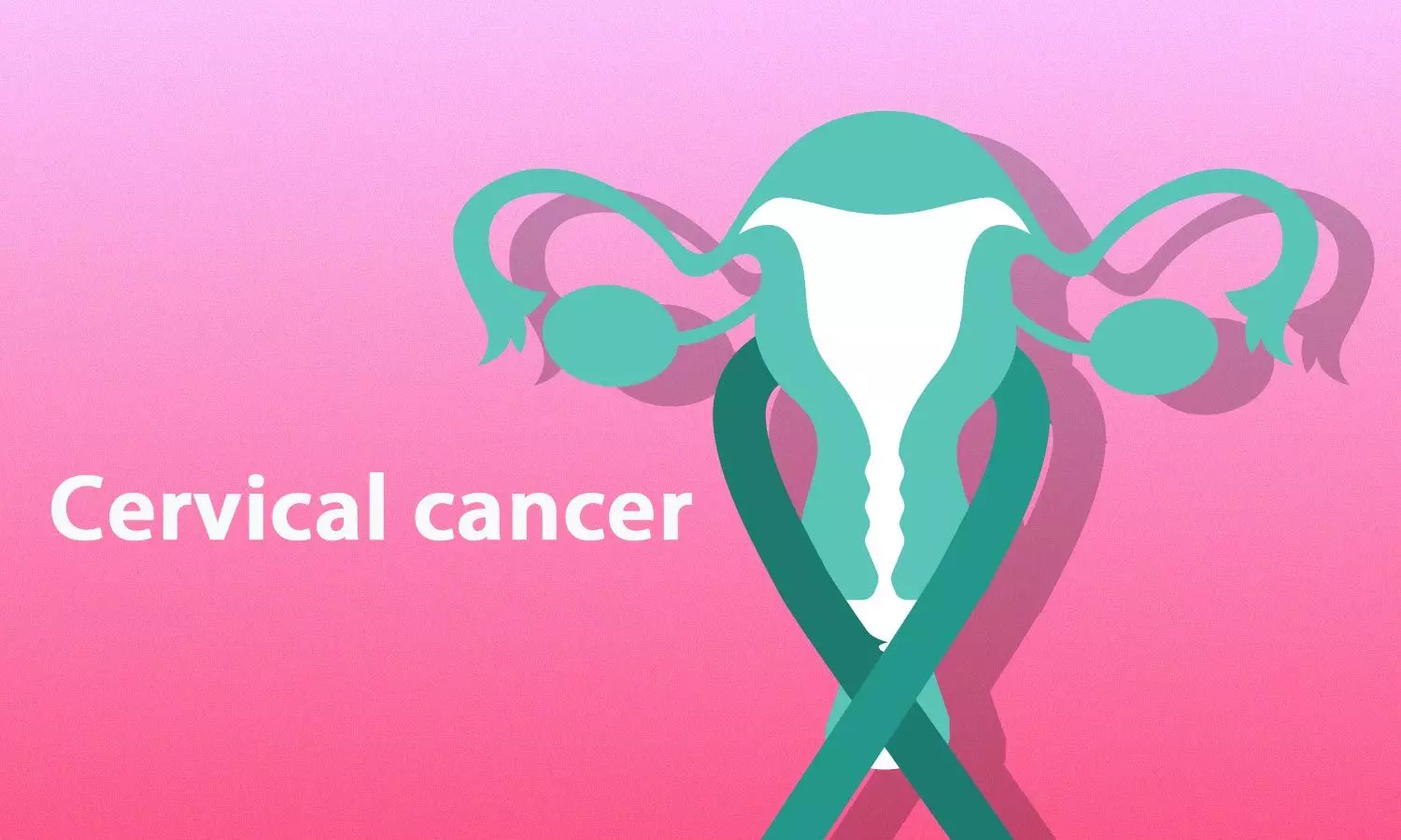 Cervical Cancer Screening Process Explained, Comparison of HPV, Pap, and HPV/Pap Tests, Age-Related Considerations in Cervical Cancer Screening
