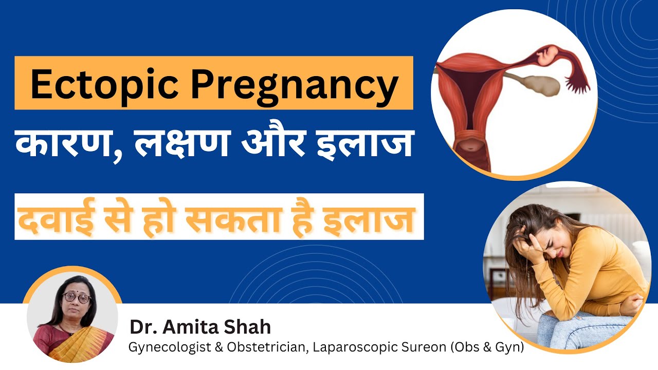 Ectopic Pregnancy What is ectopic pregnancy, symptoms and causes. Ectopic Pregnancy Hindi