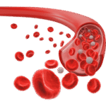 Excessive Blood Loss