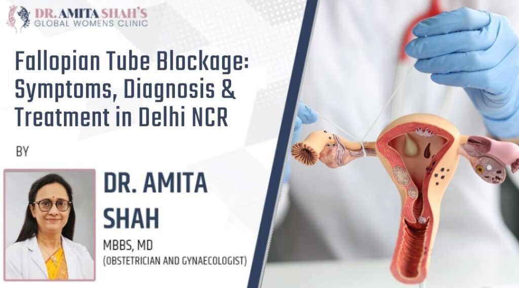 Fallopian Tube Blockage: Symptoms, Diagnosis & Treatment in Delhi NCR