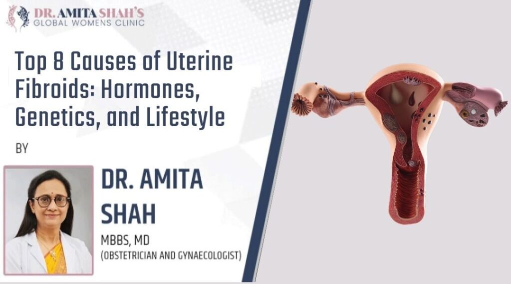 Top 8 Causes of Uterine Fibroids Hormones Genetics and Lifestyle