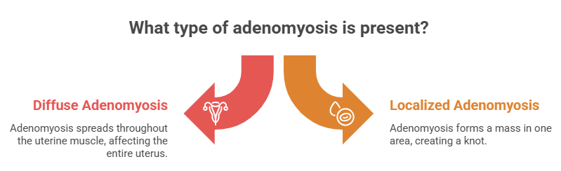 Types of Adenomyosis