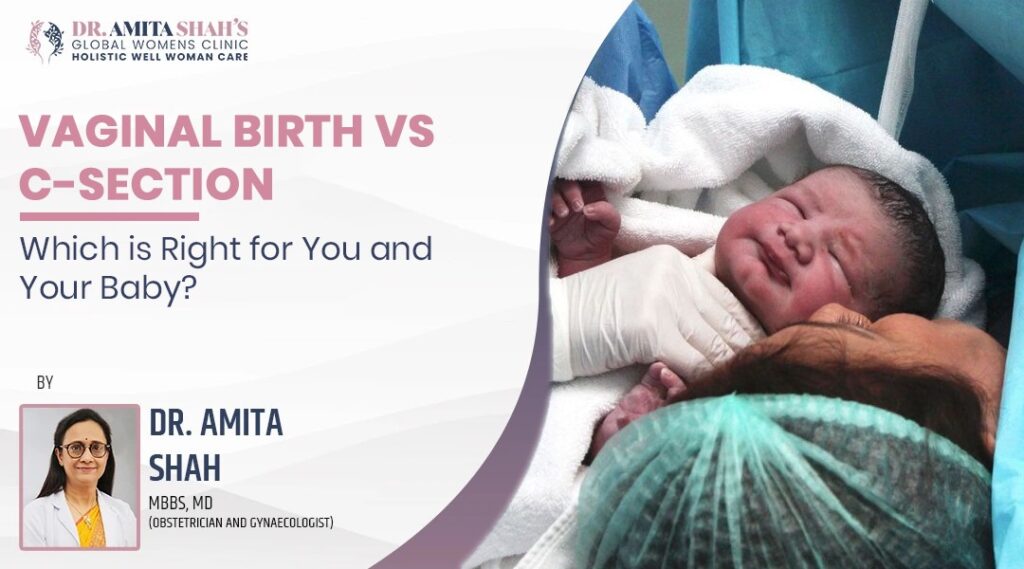 Vaginal Birth vs C Section Which is Right for You and Your Baby