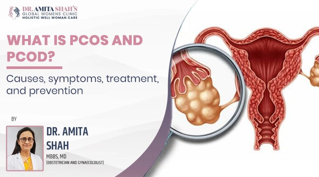 What Is Pcos And Pcod Causes Symptoms Treatment And Prevention