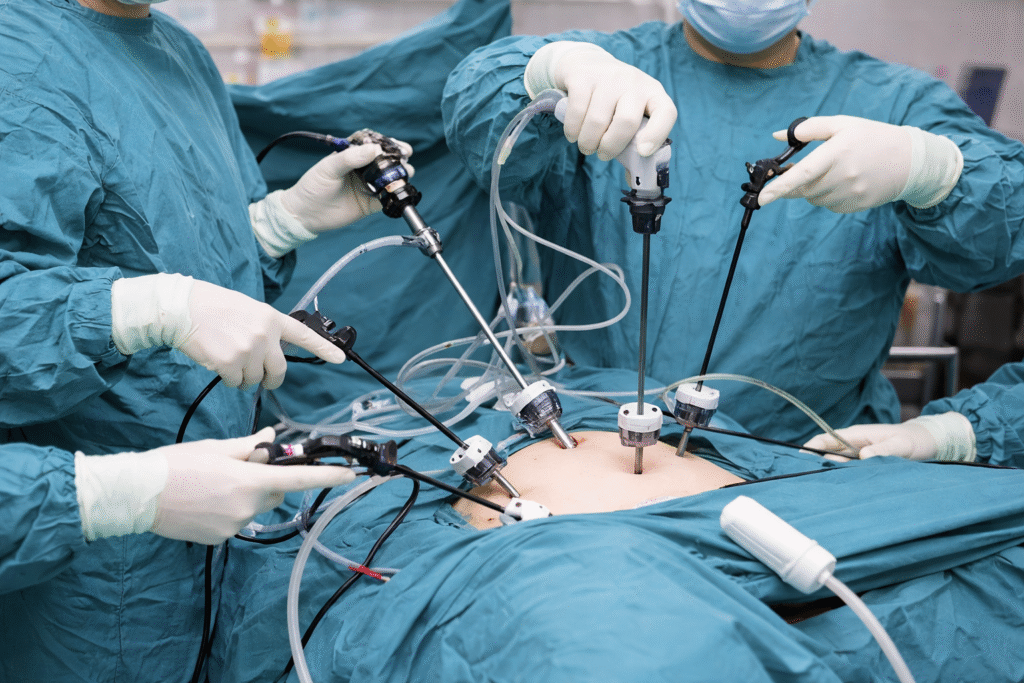 laparoscopic surgery