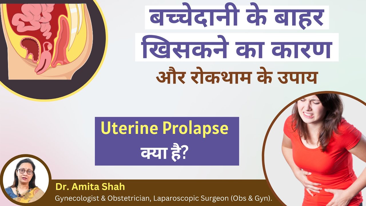 what is uterine prolapse